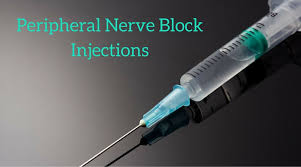 Peripheral Nerver Block Injections